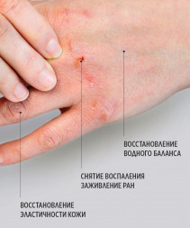 SMART   Бальзам для быстрого восстановления кожи  HEALING BALM   150мл